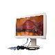 Factory Price Medical Grade Shutterstock LED Screens Video Android-Endoscope Screen Endoscope Monitor manufacturer