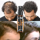 Private Label Anti Loss Thicken Hair Growth Serum Hair Growth Regrowth Oil Spray manufacturer