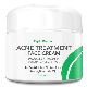  Natural Acne Treatment Face Cream Hormonal & Cystic Acne Pimple Cream