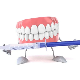 Price Concessions Fast Effective Whitening Fixing Teeth Teeth Whitening Kit