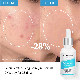 Deep Cleansing BHA Anti-Acne Salicylic Acid Face Serum