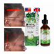  Nourishing Hair-Repairing Growth Scalp Care Wholesale Rosemary Essential Oil