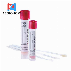Virus Transport Medium Vtm with Throat Nylon Flocked Swab Sample Collection Flexible Handle Transport Applicator with Long Tube manufacturer