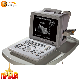  Cheap Price Ultrasound Portable Ultrasound Diagnostic Scanner with High Promotion