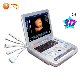  Portable Diagnostic 800d Ultrasound Laptop Machine Medical Portable Ultrasound Scanner