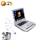 Full Digital Portable Ultrasound Diagnostic Scanner