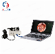  Portable Medical HDMI, SDI, USB CMOS Endoscope Camera