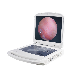 Ent USB Endoscope CCD Camera with CE